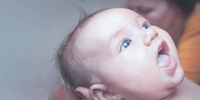 Thrush in Babies